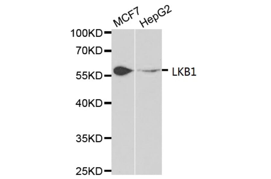 Anti-LKB1 Antibody from Bioworld Technology (BS6740) - Antibodies.com