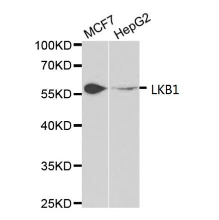 Anti-LKB1 Antibody from Bioworld Technology (BS6740) - Antibodies.com