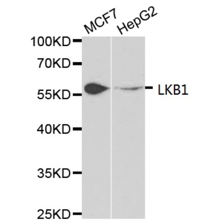 Anti-LKB1 Antibody from Bioworld Technology (BS6740) - Antibodies.com