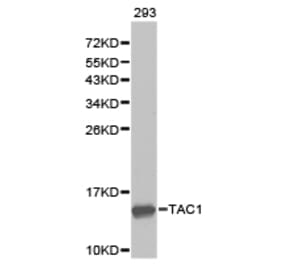 Anti-TAC1 Antibody from Bioworld Technology (BS6743) - Antibodies.com