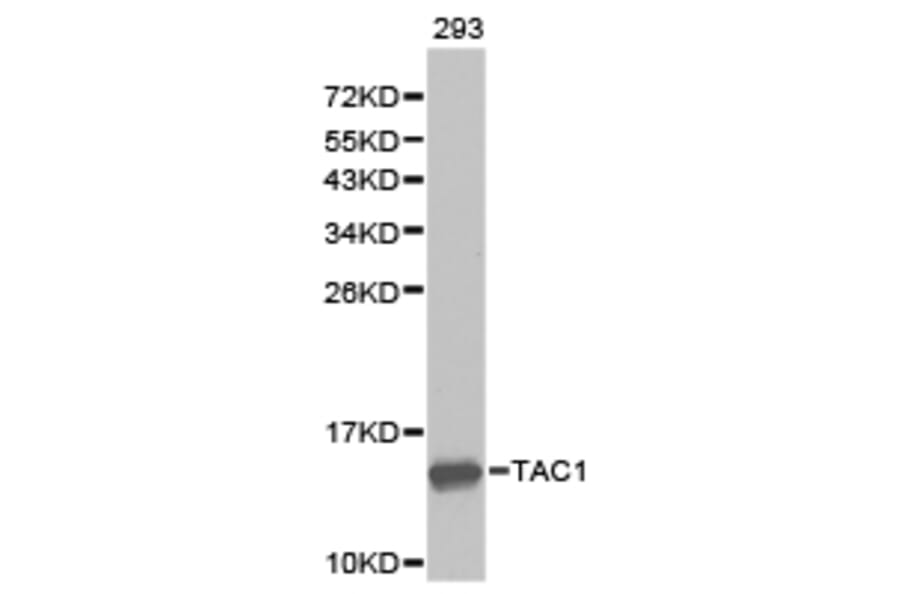 Anti-TAC1 Antibody from Bioworld Technology (BS6743) - Antibodies.com