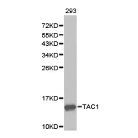 Anti-TAC1 Antibody from Bioworld Technology (BS6743) - Antibodies.com