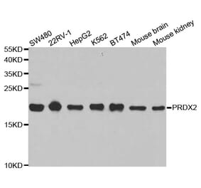 Anti-PRDX2 Antibody from Bioworld Technology (BS6744) - Antibodies.com