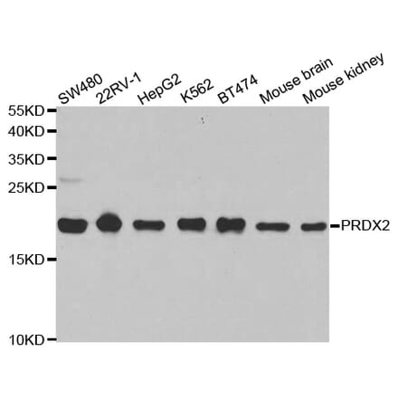 Anti-PRDX2 Antibody from Bioworld Technology (BS6744) - Antibodies.com