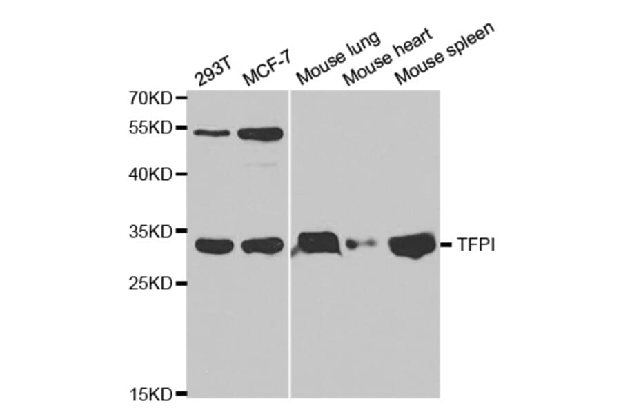 Anti-TFPI Antibody from Bioworld Technology (BS6745) - Antibodies.com