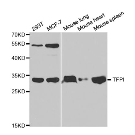 Anti-TFPI Antibody from Bioworld Technology (BS6745) - Antibodies.com