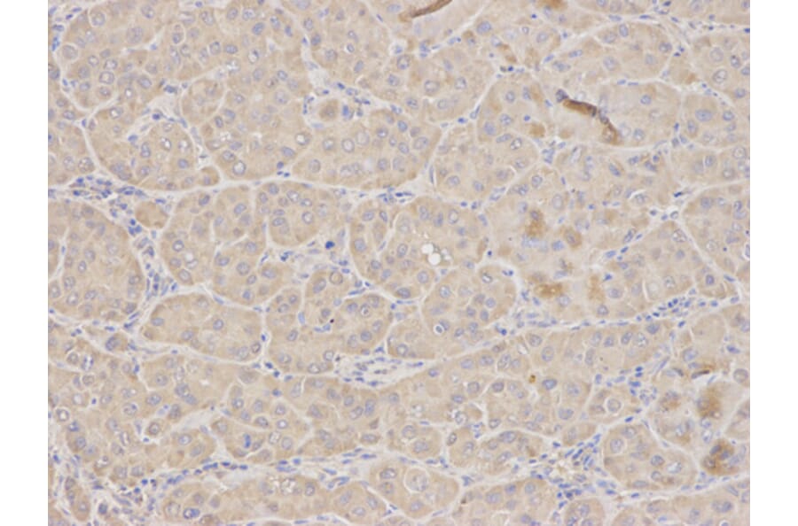 Anti-TFPI Antibody from Bioworld Technology (BS6745) - Antibodies.com
