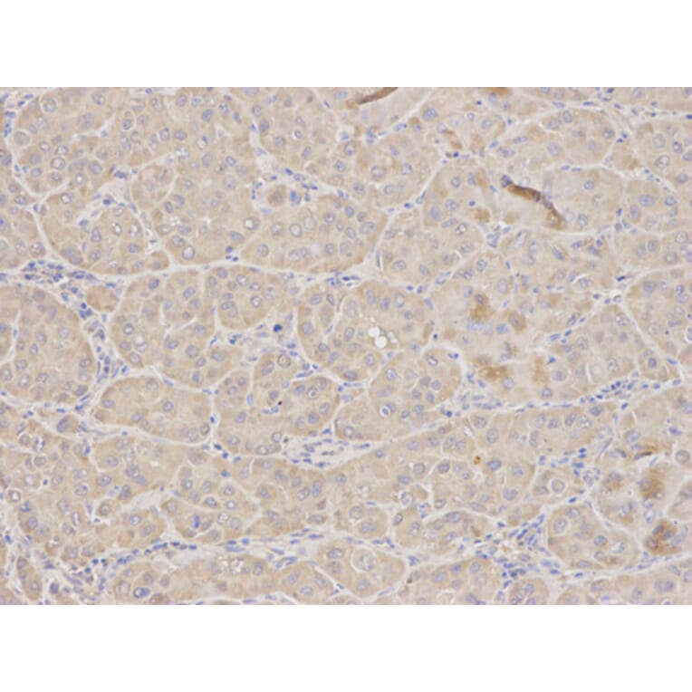 Anti-TFPI Antibody from Bioworld Technology (BS6745) - Antibodies.com