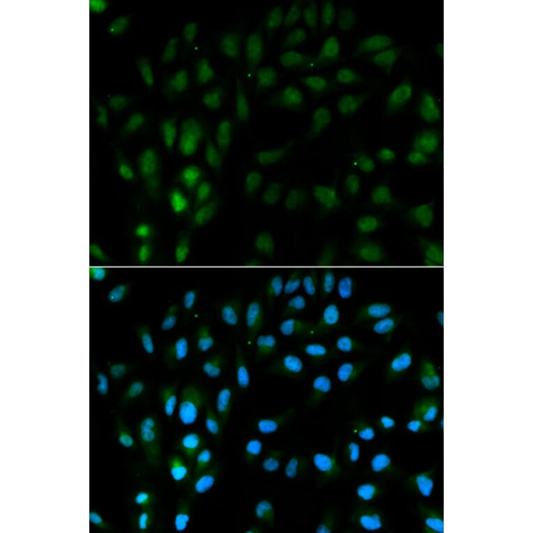 Anti-TFPI Antibody from Bioworld Technology (BS6745) - Antibodies.com