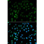 Anti-TFPI Antibody from Bioworld Technology (BS6745) - Antibodies.com