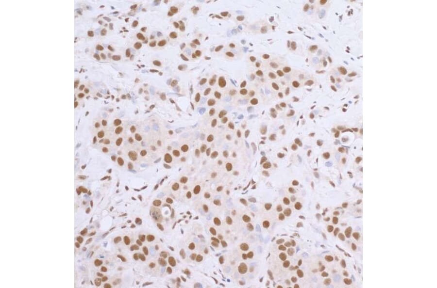 Immunohistochemistry - Goat Anti-Rabbit IgG H&L Antibody (HRP), Cross-Absorbed (A294949) - Antibodies.com