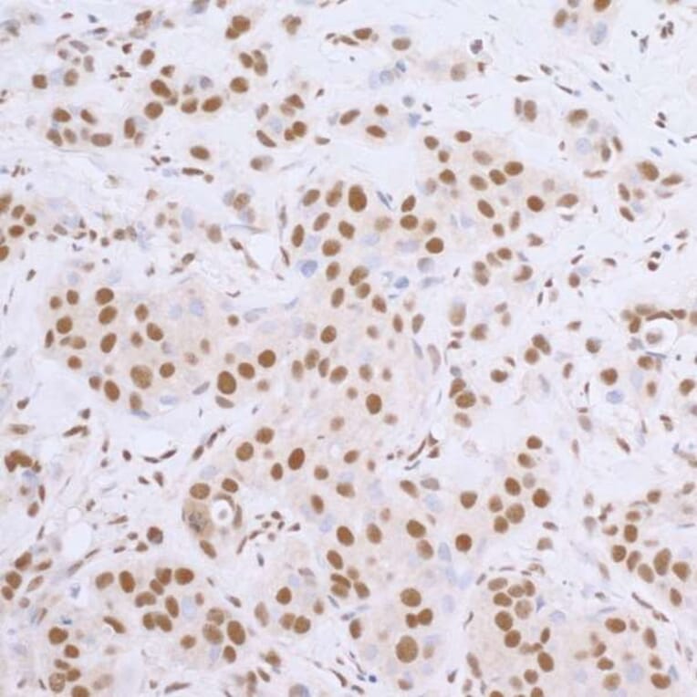 Immunohistochemistry - Goat Anti-Rabbit IgG H&L Antibody (HRP), Cross-Absorbed (A294949) - Antibodies.com
