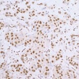 Immunohistochemistry - Goat Anti-Rabbit IgG H&L Antibody (HRP), Cross-Absorbed (A294949) - Antibodies.com