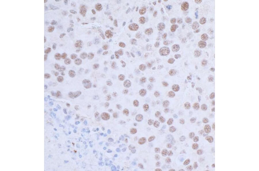 Immunohistochemistry - Anti-HAUSP / USP7 Antibody (A295211) - Antibodies.com