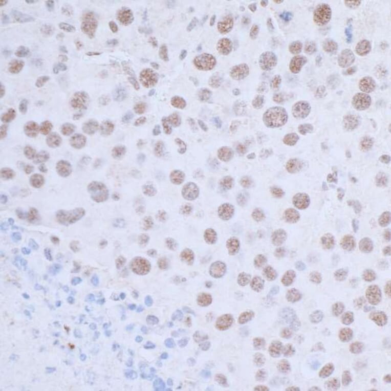 Immunohistochemistry - Anti-HAUSP / USP7 Antibody (A295211) - Antibodies.com