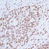 Immunohistochemistry - Anti-HAUSP / USP7 Antibody (A295211) - Antibodies.com