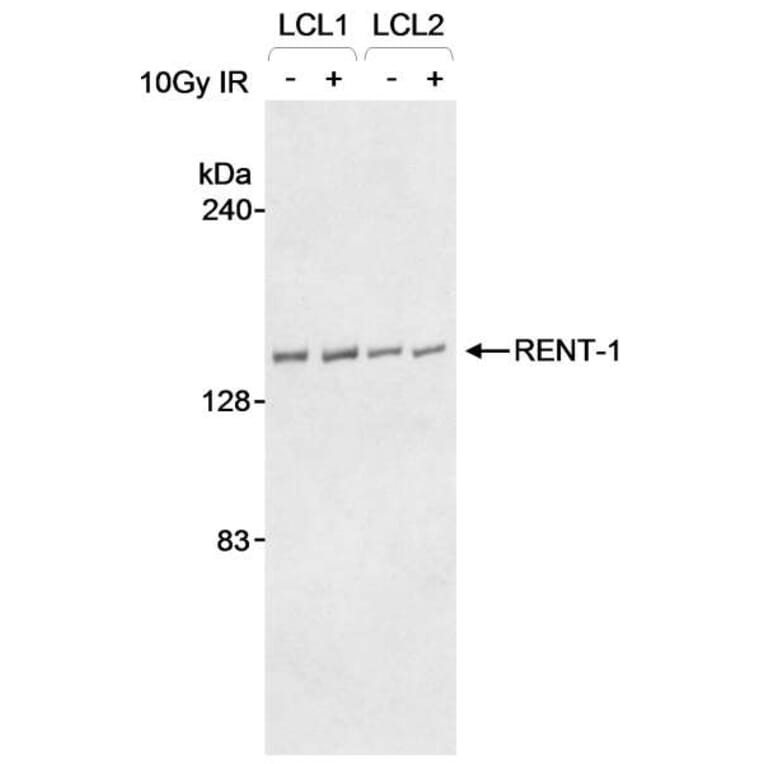 Western Blot - Anti-RENT1 / hUPF1 Antibody (A295213) - Antibodies.com
