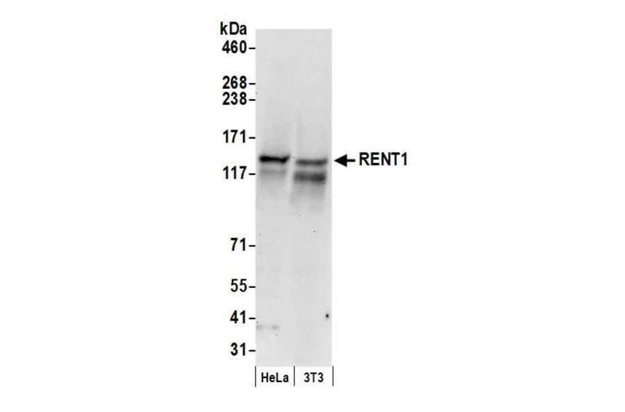 Western Blot - Anti-RENT1 / hUPF1 Antibody (A295213) - Antibodies.com