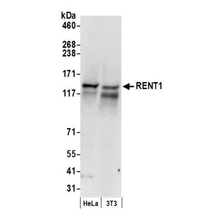 Western Blot - Anti-RENT1 / hUPF1 Antibody (A295213) - Antibodies.com