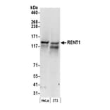 Western Blot - Anti-RENT1 / hUPF1 Antibody (A295213) - Antibodies.com
