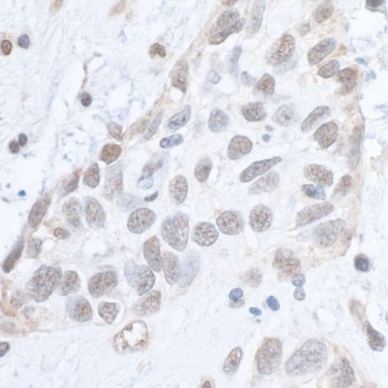 Immunohistochemistry - Anti-SMC1A (phospho Ser966) Antibody (A295220) - Antibodies.com