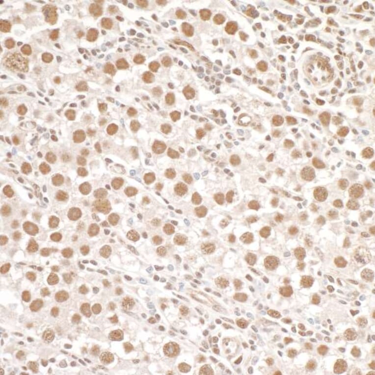 Immunohistochemistry - Anti-SMC1A (phospho Ser966) Antibody (A295220) - Antibodies.com