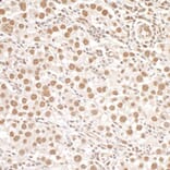 Immunohistochemistry - Anti-SMC1A (phospho Ser966) Antibody (A295220) - Antibodies.com