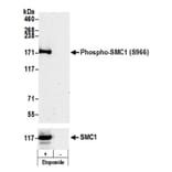 Western Blot - Anti-SMC1A (phospho Ser966) Antibody (A295220) - Antibodies.com
