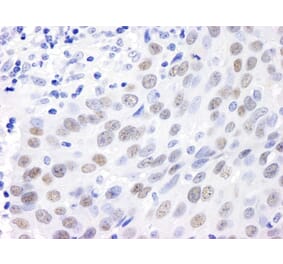 Immunohistochemistry - Anti-MDC1 Antibody (A295223) - Antibodies.com