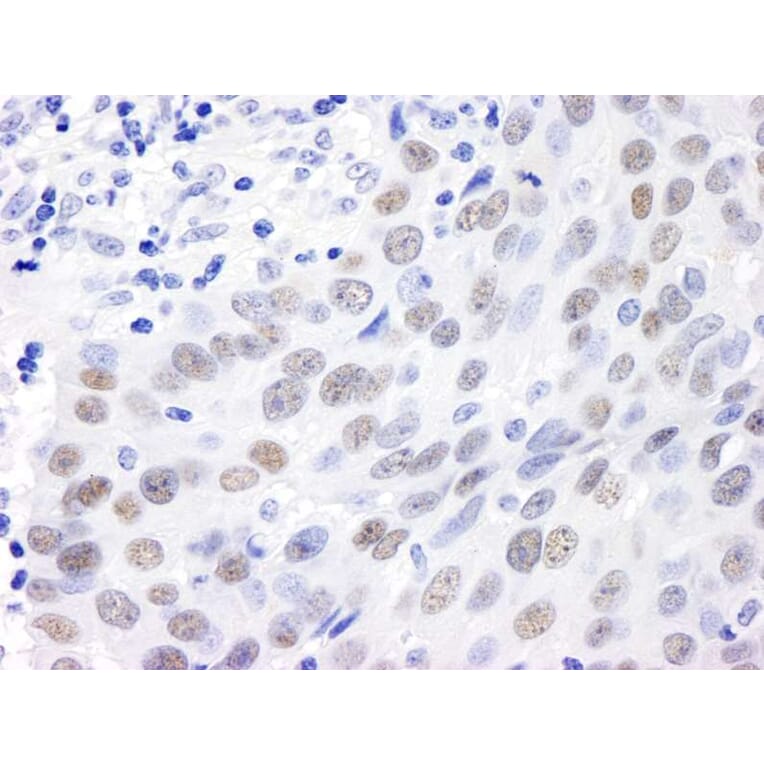 Immunohistochemistry - Anti-MDC1 Antibody (A295223) - Antibodies.com