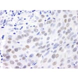 Immunohistochemistry - Anti-MDC1 Antibody (A295223) - Antibodies.com