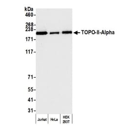 Western Blot - Anti-Topoisomerase II alpha Antibody (A295224) - Antibodies.com