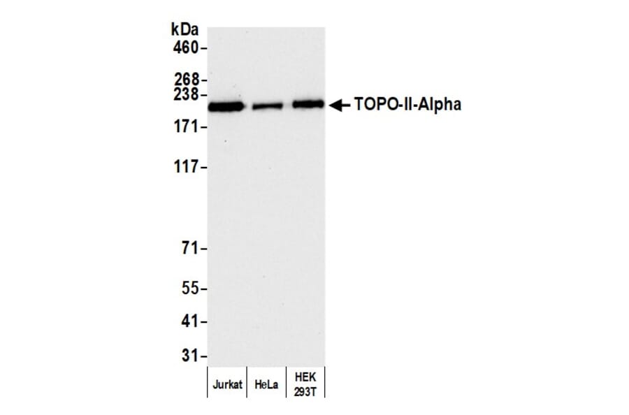Western Blot - Anti-Topoisomerase II alpha Antibody (A295224) - Antibodies.com
