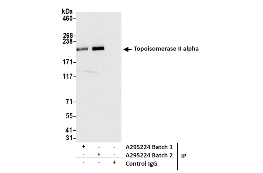 Immunoprecipitation - Anti-Topoisomerase II alpha Antibody (A295224) - Antibodies.com
