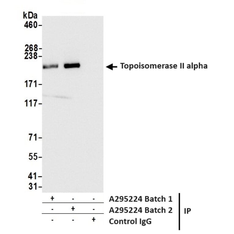 Immunoprecipitation - Anti-Topoisomerase II alpha Antibody (A295224) - Antibodies.com