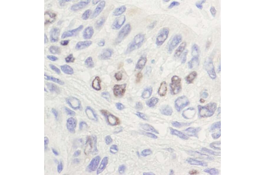 Immunohistochemistry - Anti-Topoisomerase II alpha Antibody (A295224 - Antibodies.com