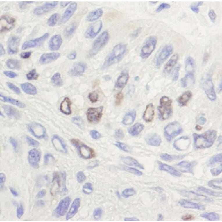 Immunohistochemistry - Anti-Topoisomerase II alpha Antibody (A295224 - Antibodies.com