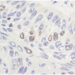 Immunohistochemistry - Anti-Topoisomerase II alpha Antibody (A295224 - Antibodies.com