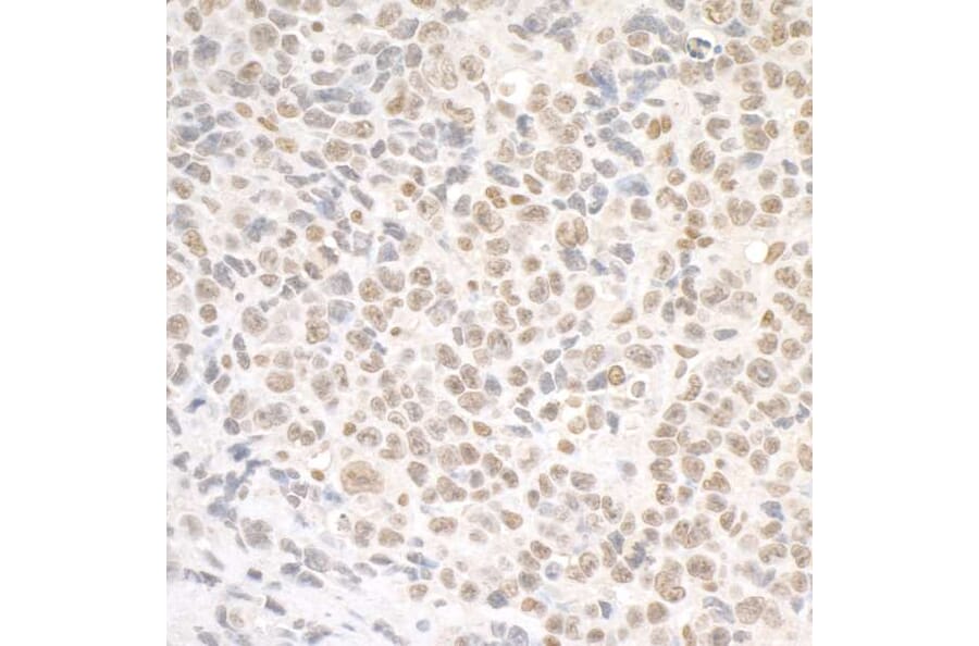 Immunohistochemistry - Anti-SMC1A Antibody (A295225) - Antibodies.com