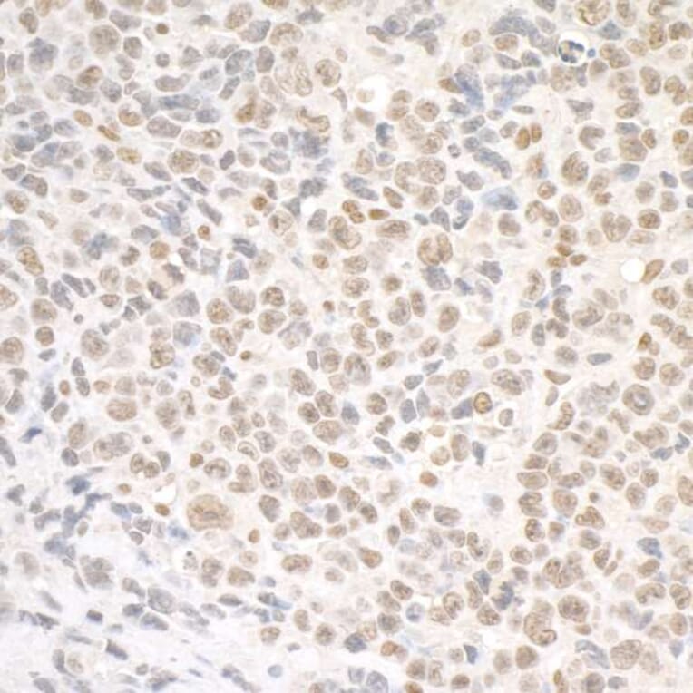 Immunohistochemistry - Anti-SMC1A Antibody (A295225) - Antibodies.com