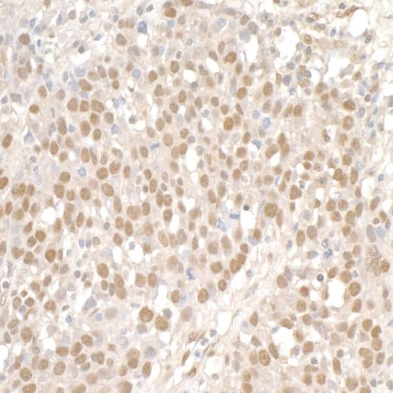 Immunohistochemistry - Anti-SMC1A Antibody (A295225) - Antibodies.com