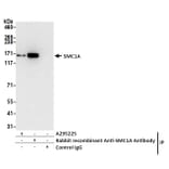 Immunoprecipitation - Anti-SMC1A Antibody (A295225) - Antibodies.com