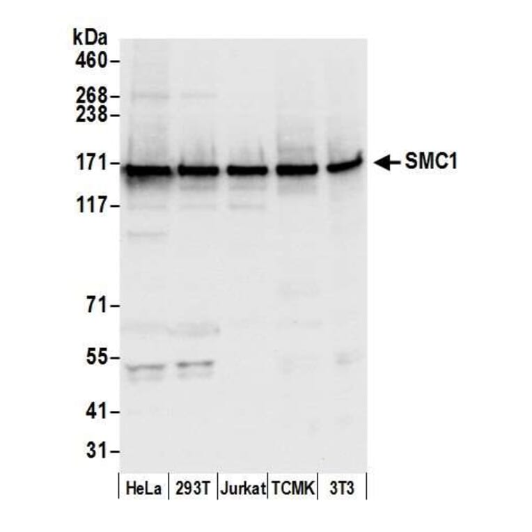 Western Blot - Anti-SMC1A Antibody (A295225) - Antibodies.com