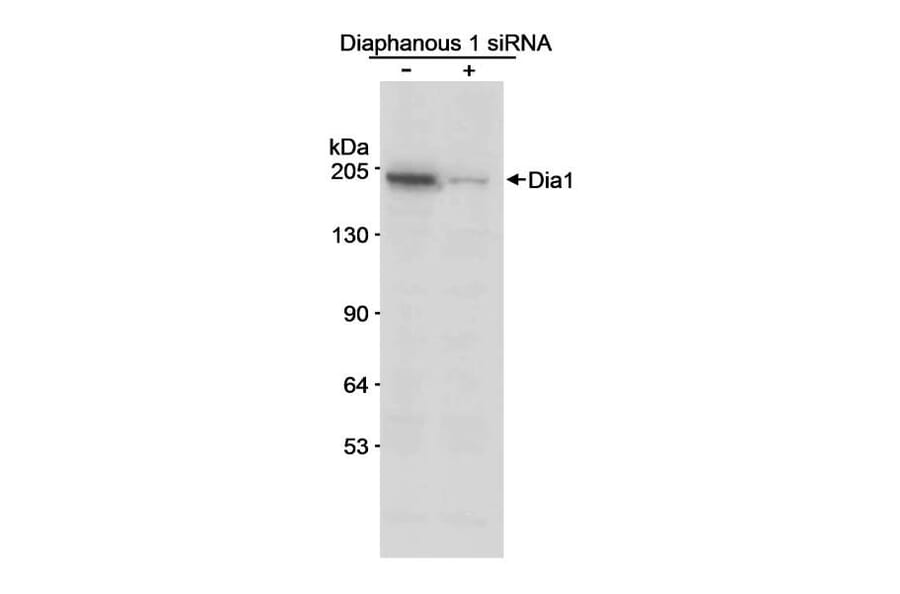 Western Blot - Anti-DIAPH1 Antibody (A295241) - Antibodies.com