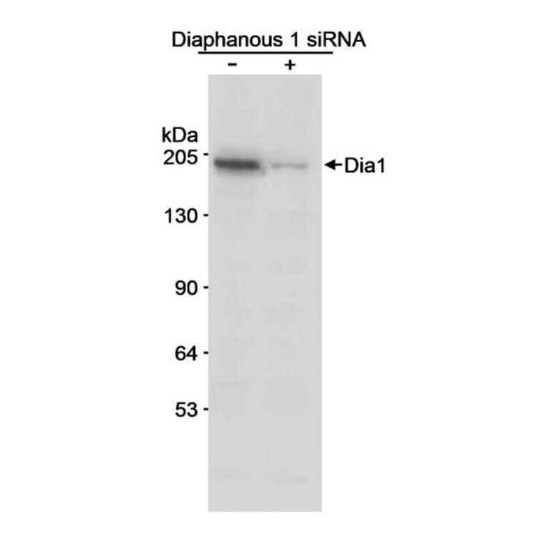 Western Blot - Anti-DIAPH1 Antibody (A295241) - Antibodies.com