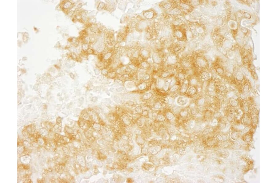 Immunohistochemistry - Anti-DIAPH1 Antibody (A295241) - Antibodies.com