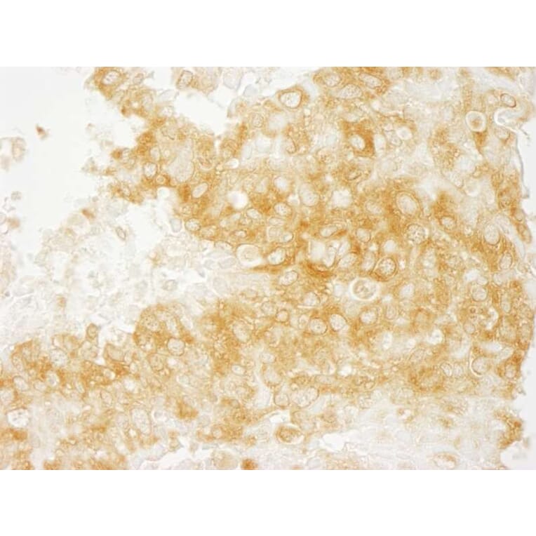 Immunohistochemistry - Anti-DIAPH1 Antibody (A295241) - Antibodies.com