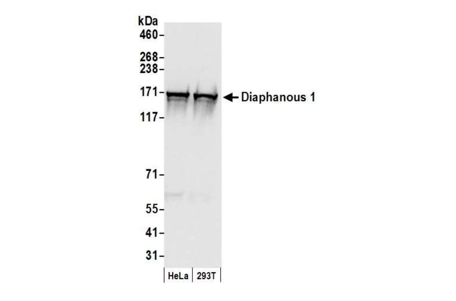 Western Blot - Anti-DIAPH1 Antibody (A295241) - Antibodies.com