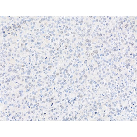 Immunohistochemistry - Anti-gamma Histone H2A.X Antibody (A295244) - Antibodies.com