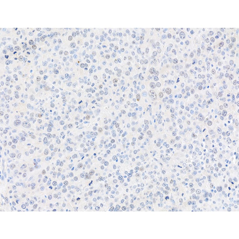 Immunohistochemistry - Anti-gamma Histone H2A.X Antibody (A295244) - Antibodies.com